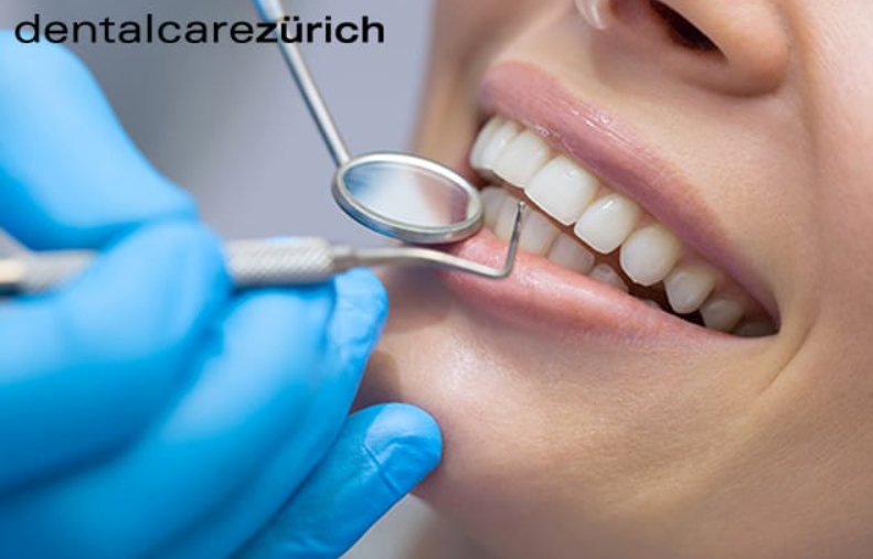 Professionelle Zahnreinigung bei dentalcarezürich